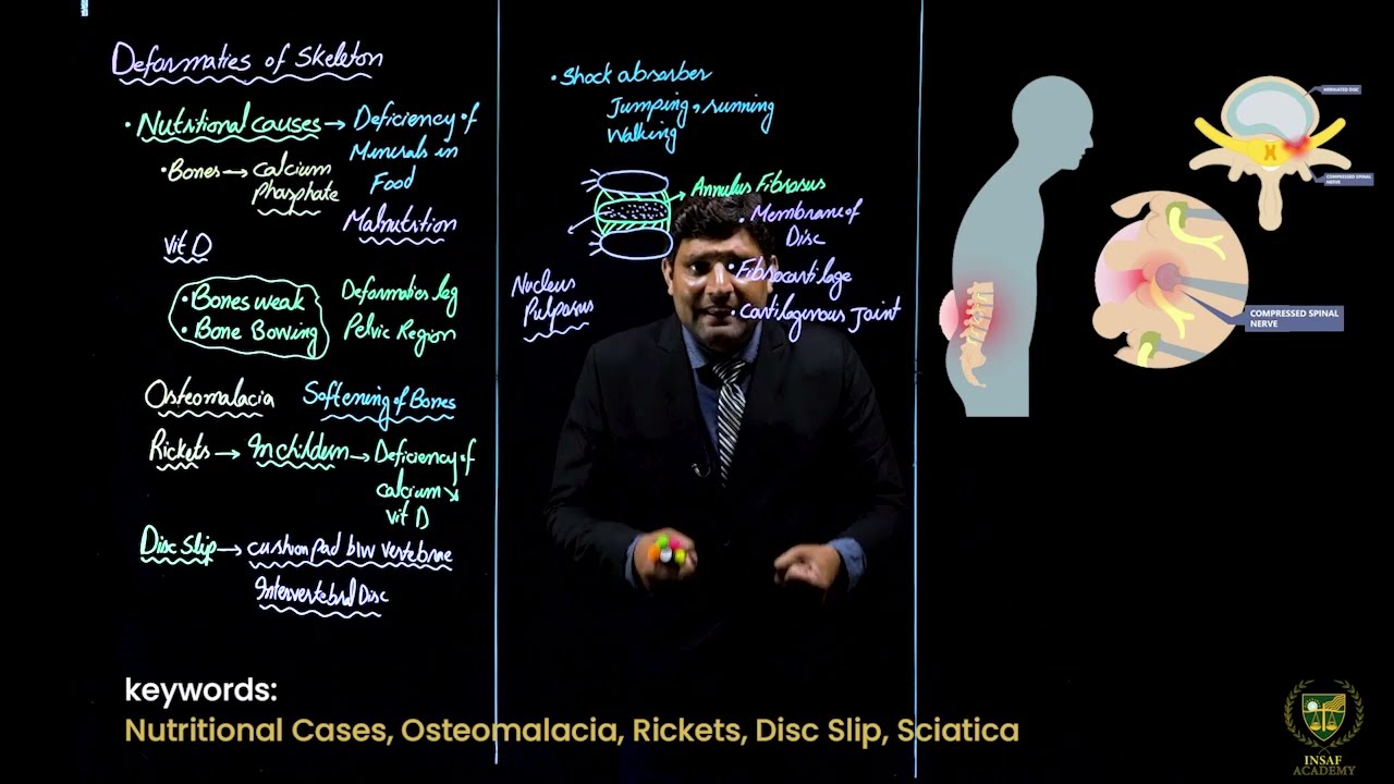 Deformities of Skeleton (part 2) || 12TH BIOLOGY || CHP 16 || LECTURE 16 ||