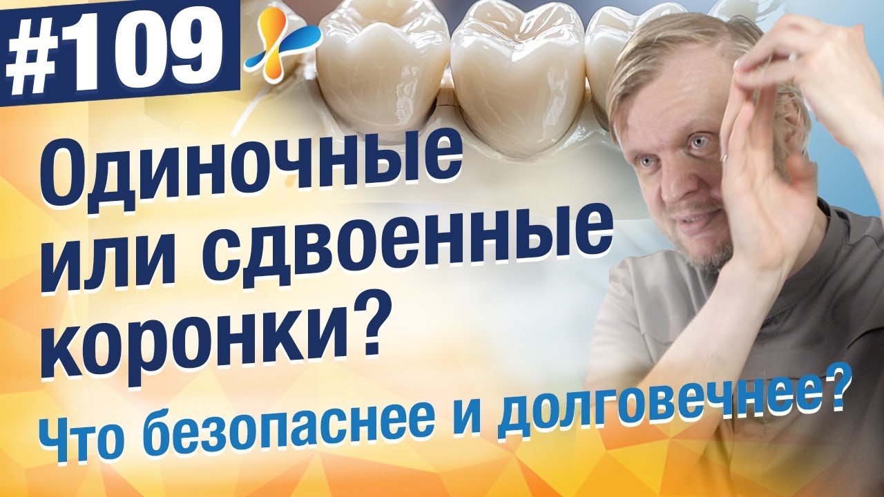 Сравнение: сдвоенные коронки vs одиночные — что лучше для ваших зубов?