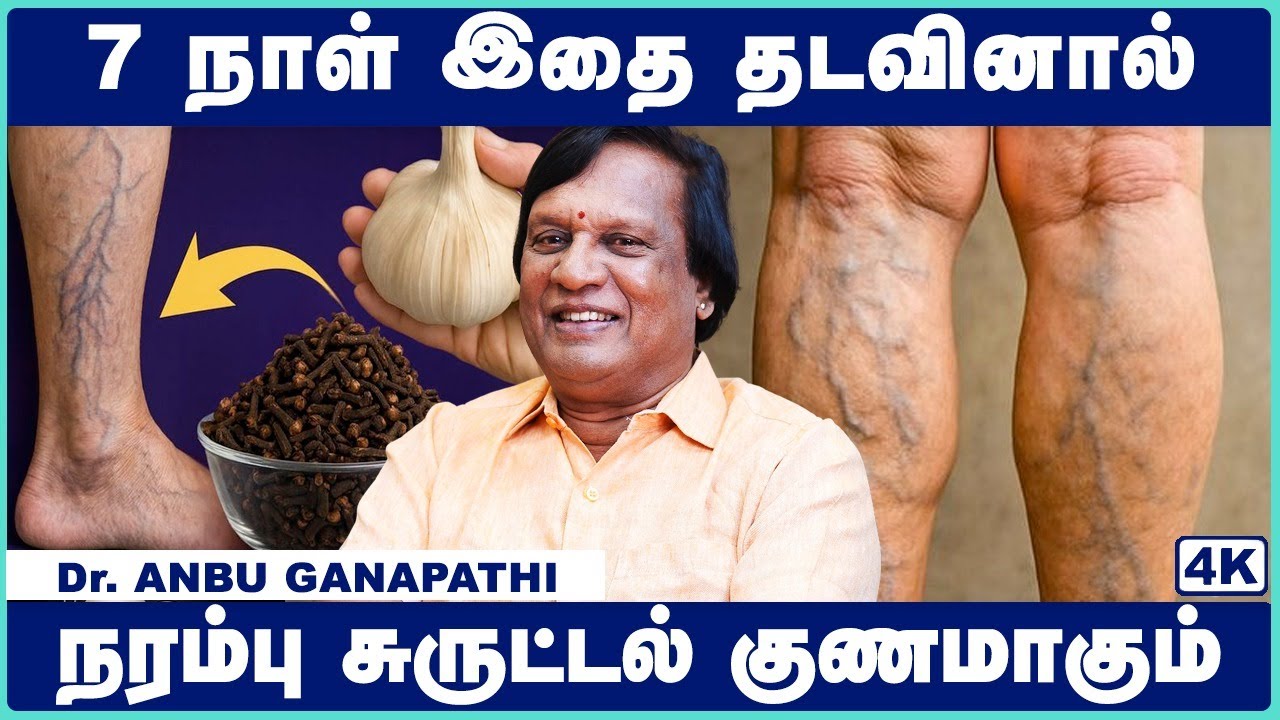 வெரிகோஸ் வெயின் அறிகுறிகள் | vericose vein problem in tamil | Narambu surutal in tamil | CosmoHealth