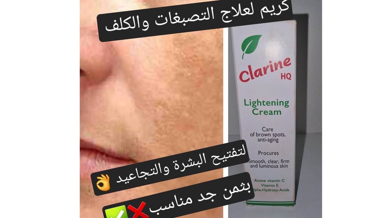 clarine HQ كريم غني بالهيديروكينون لعلاج الكلف وتصبغات وتفتيح البشرة ولتجاعيد البشرة وبثمن جد مناسب