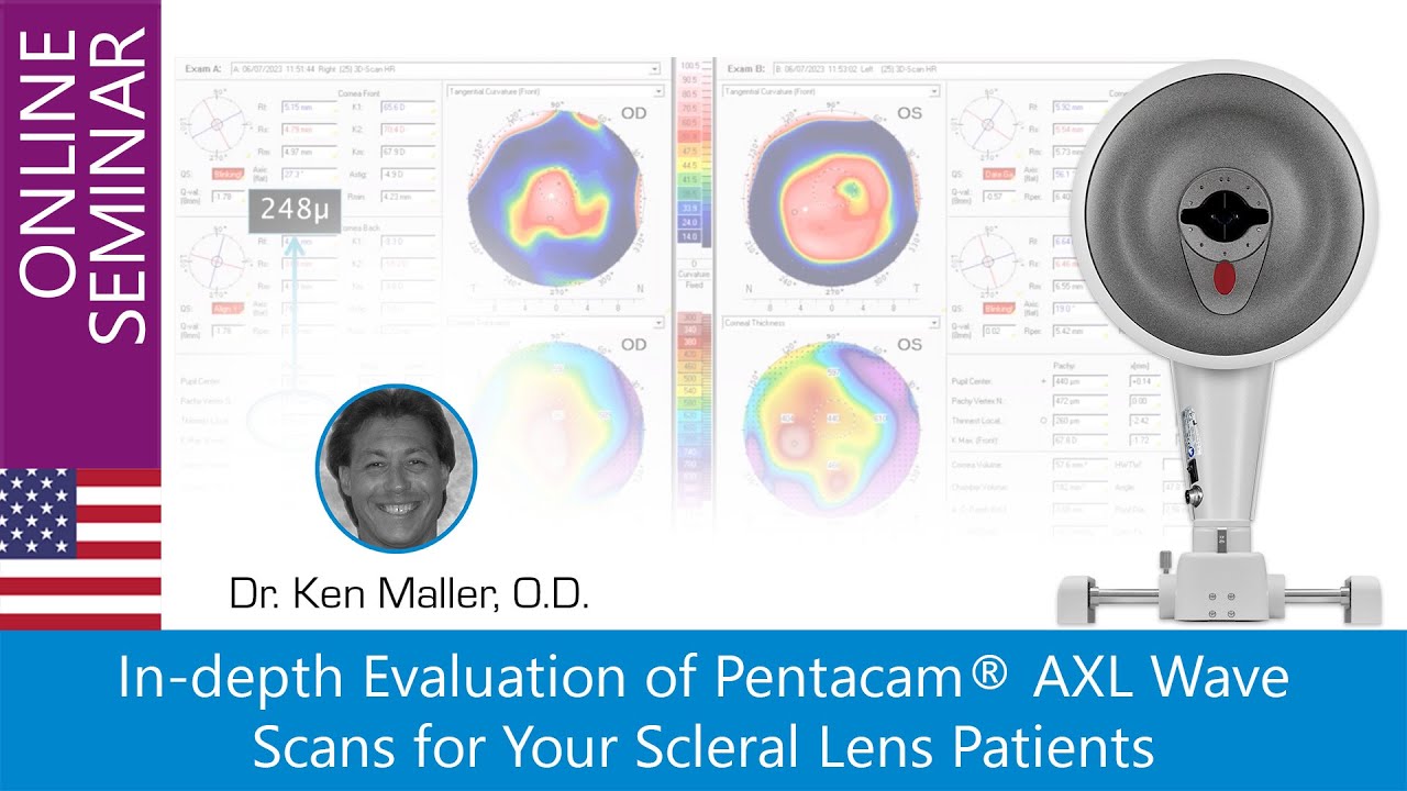 In-depth Evaluation of Pentacam® AXL Wave Scans for Your Scleral Lens Patients
