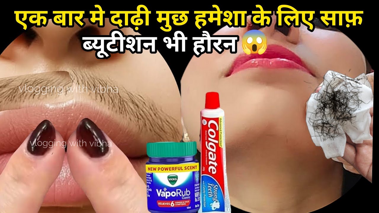 Vicks का क्रीम घर पे बना कर लगाओ तुरंत दाढ़ी मूछ साफ😱रिजल्ट देख कर हैरान || hair removal at home