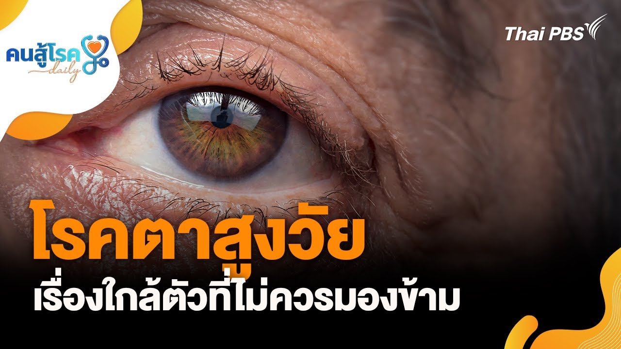 คนสู้โรค Daily : โรคตาสูงวัย เรื่องใกล้ตัวที่ไม่ควรมองข้าม | 4 ก.พ. 69