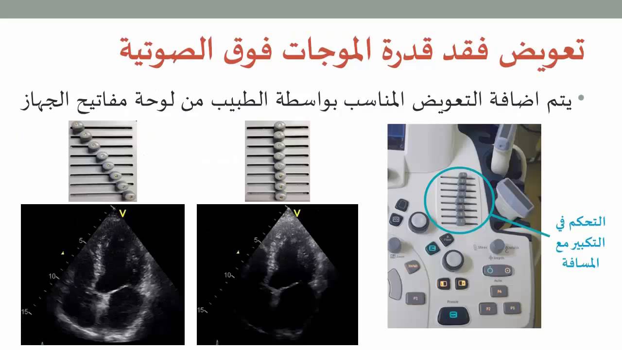 التصوير الطبي 8: تعريف بأجهزة التصوير بالموجات فوق الصوتية الحالية و قراءة الصور