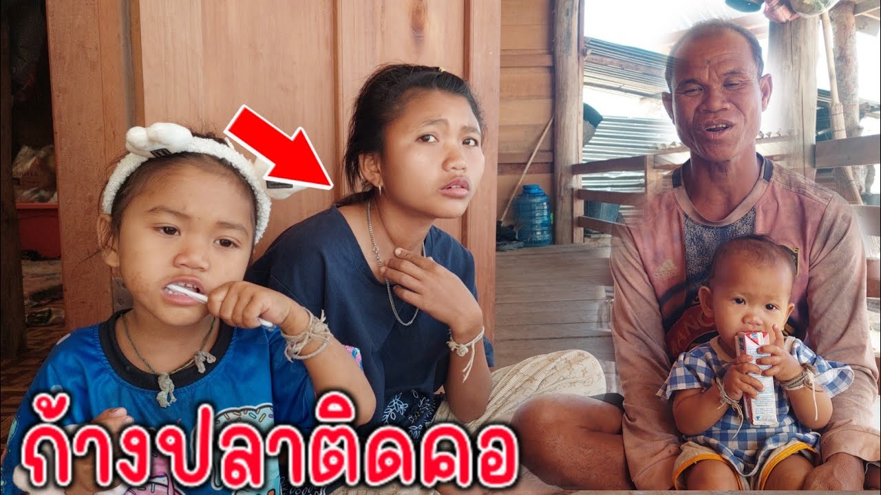 ด่วน น้องลอยก้างปลาติดคอ จนให้พ่อบ่าวนง สะเดาะออก 11 ก.พ 2026
