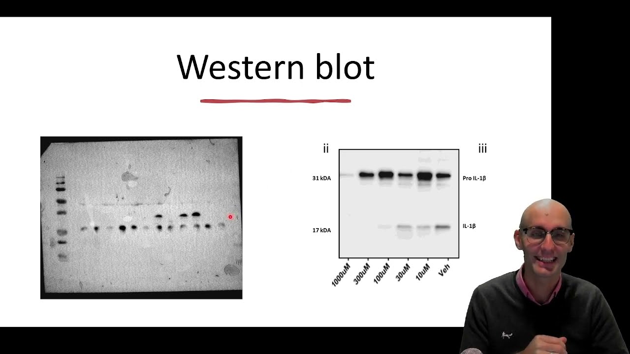 What is a Western Blot and how does it work?