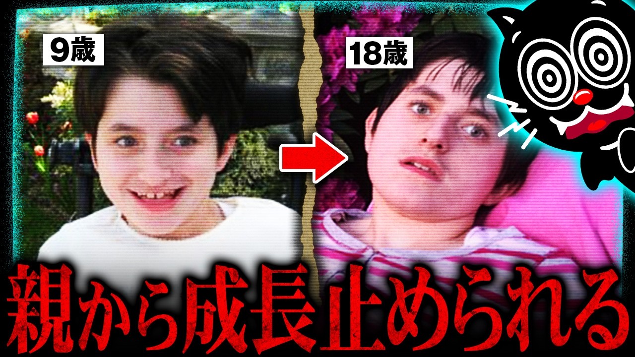 一生9歳のまま…親から成長しない手術を受けた少女アシュリーX