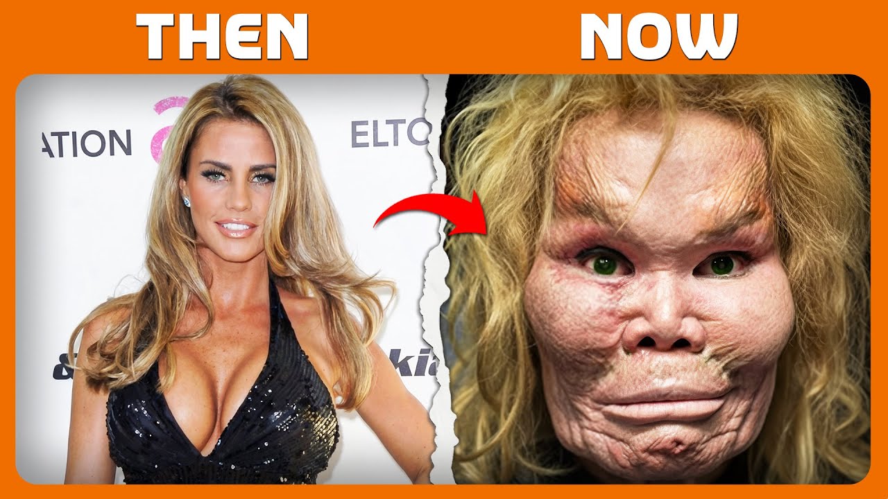 50+ Celebrities you won't Recognize After their Plastic Surgery, THEN & NOW