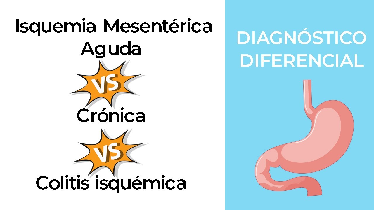 Diagnóstico Diferencial. Isquemia Mesentérica Aguda vs Crónica vs Colitis isquémica