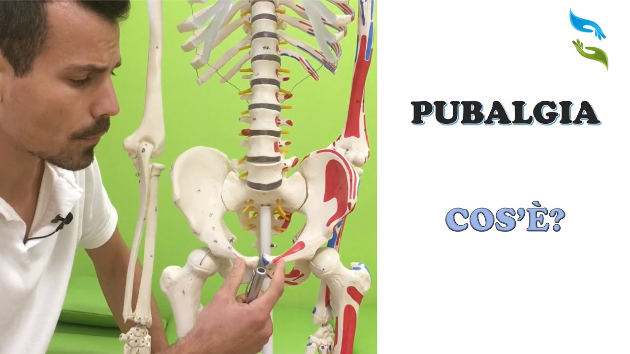 Pubalgia,  cause e catteristiche