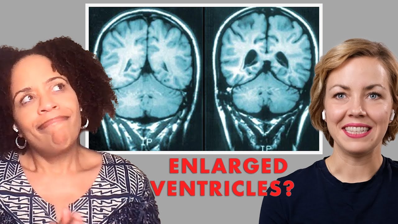 Can Brain Scans and Imaging Help in Diagnosing Schizophrenia? | with Dr. Tracey Marks