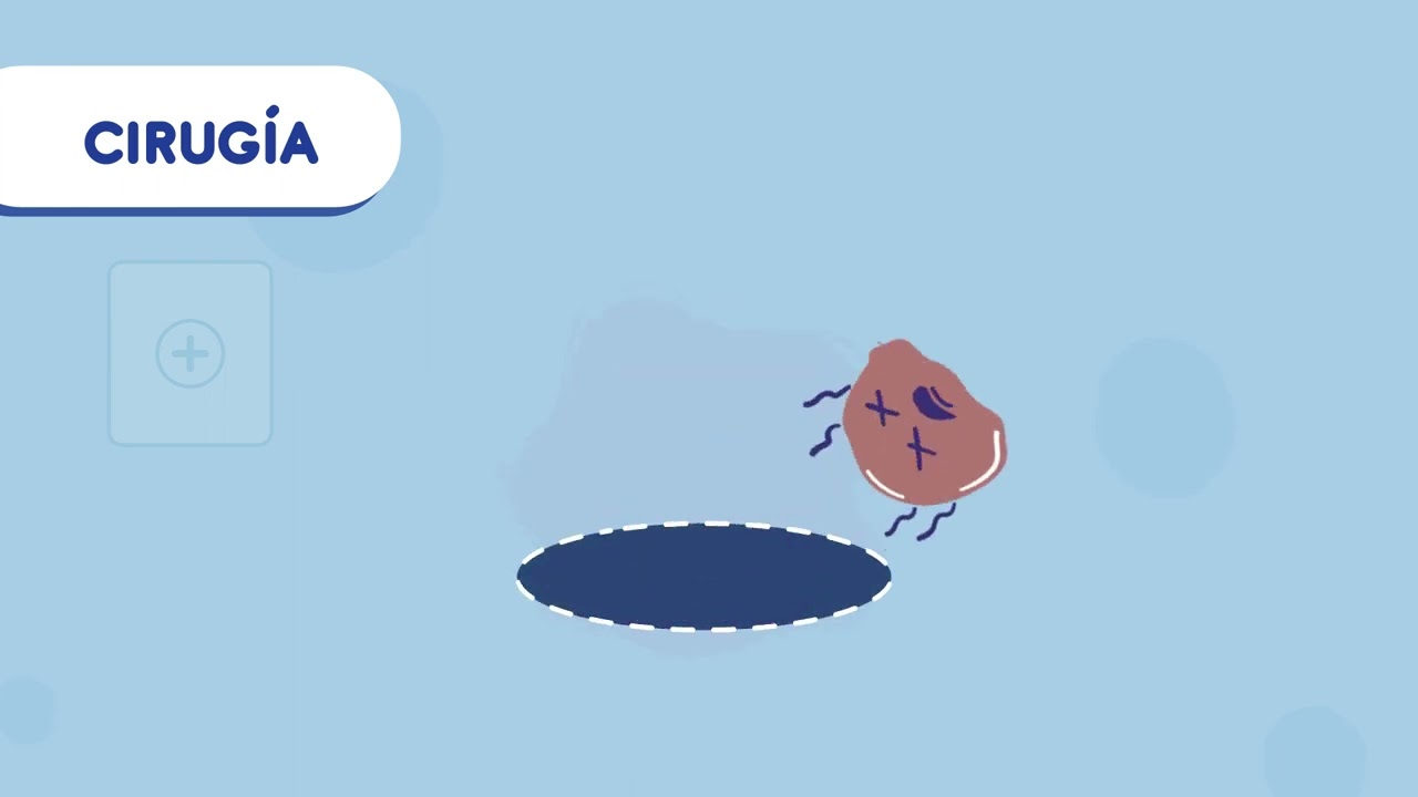 Tratamiento del cáncer infantil