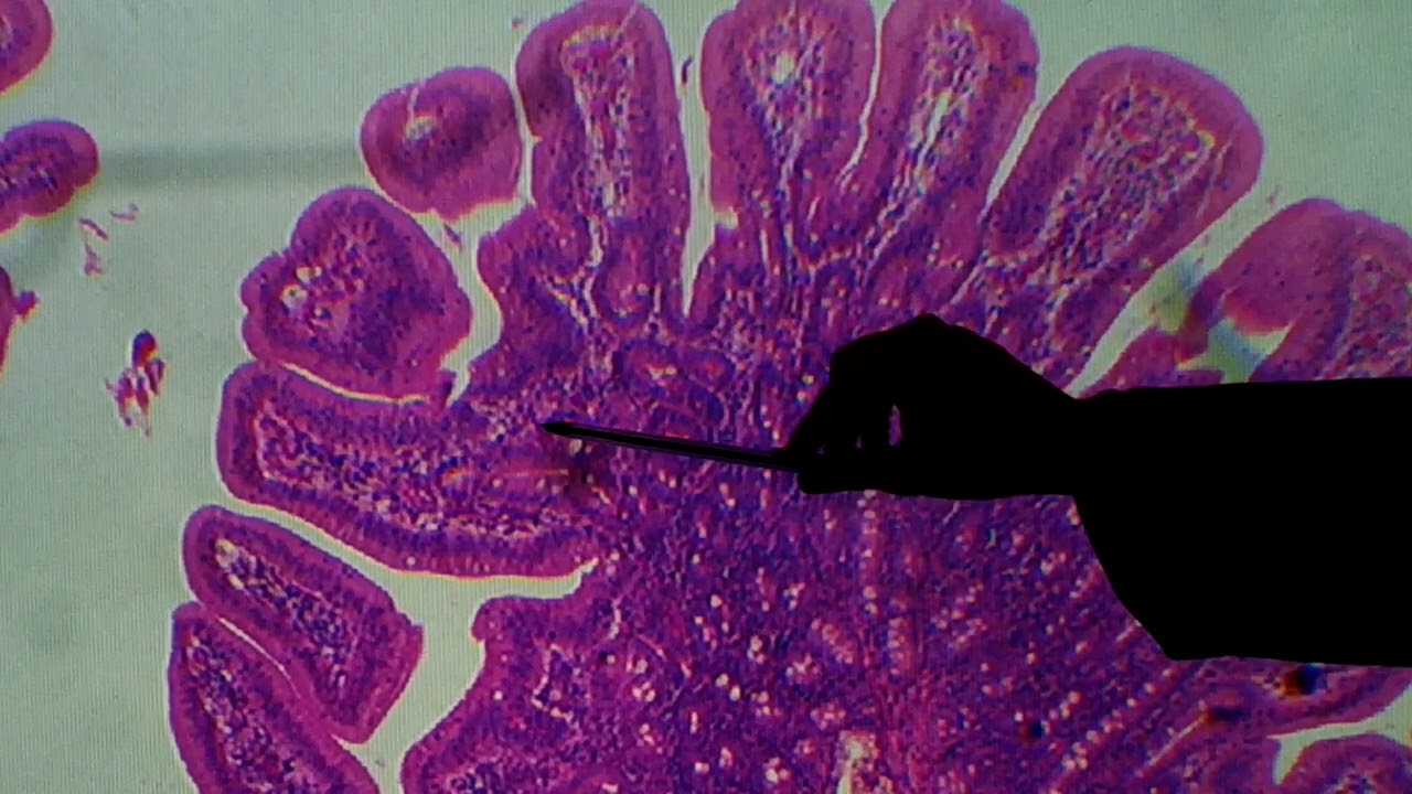 Histologia do Intestino Delgado