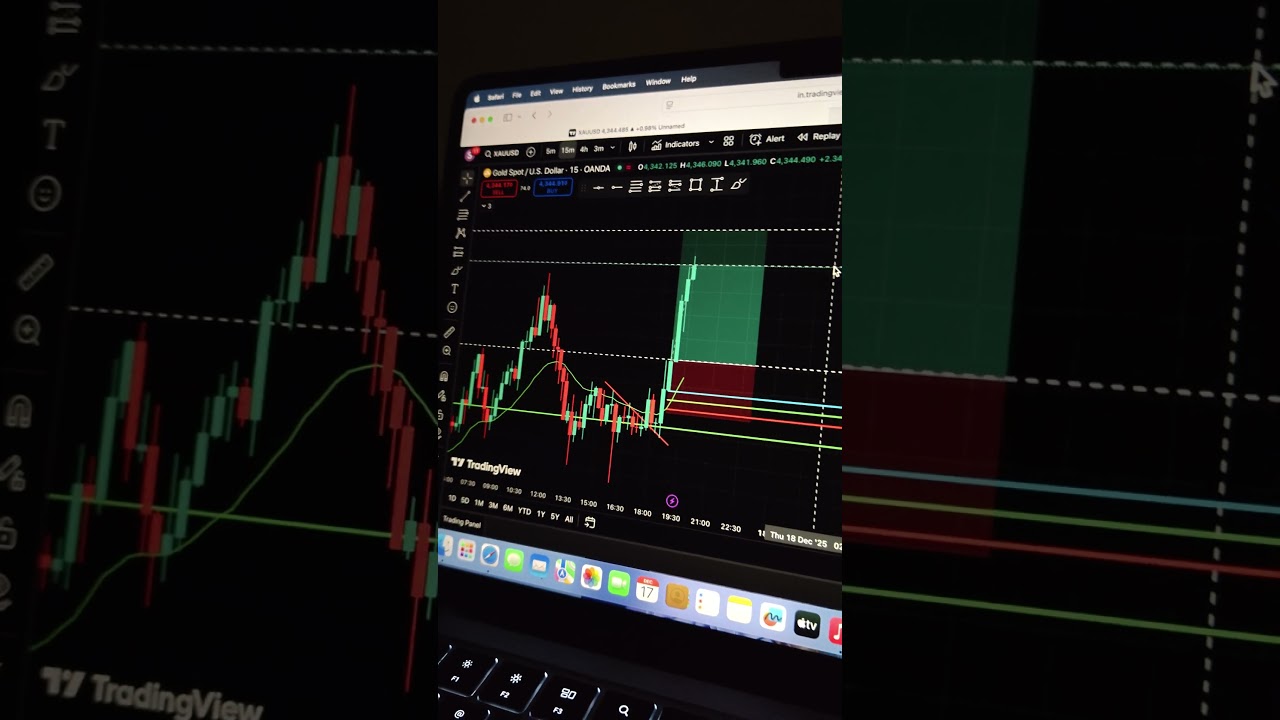 Gold Trade done and proper setup and logic base trade