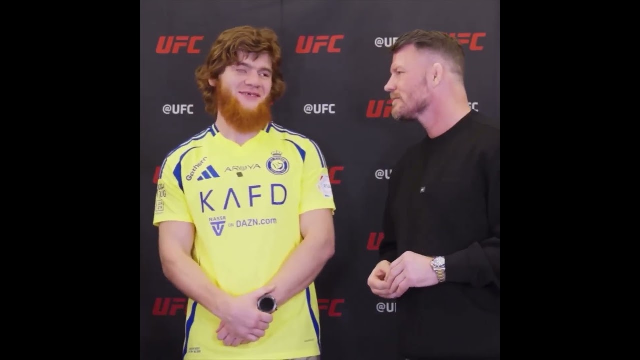 Bisping removes his EYE in front of Shara Bullet. 👁️