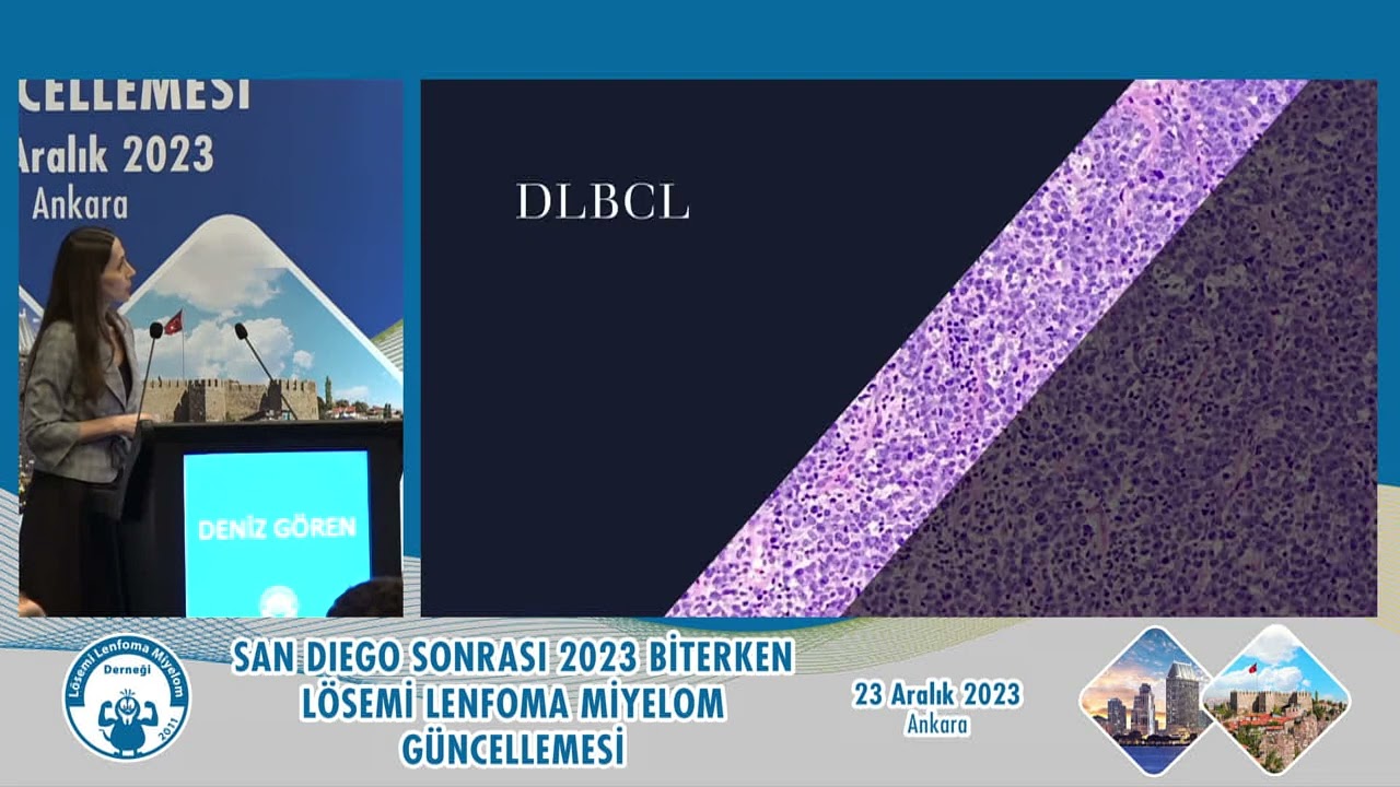 Agresif Lenfoma - Deniz Gören