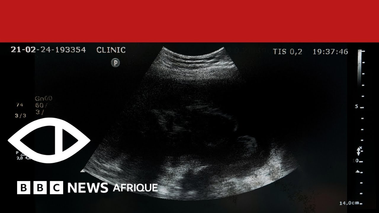 L'arnaque de la grossesse 