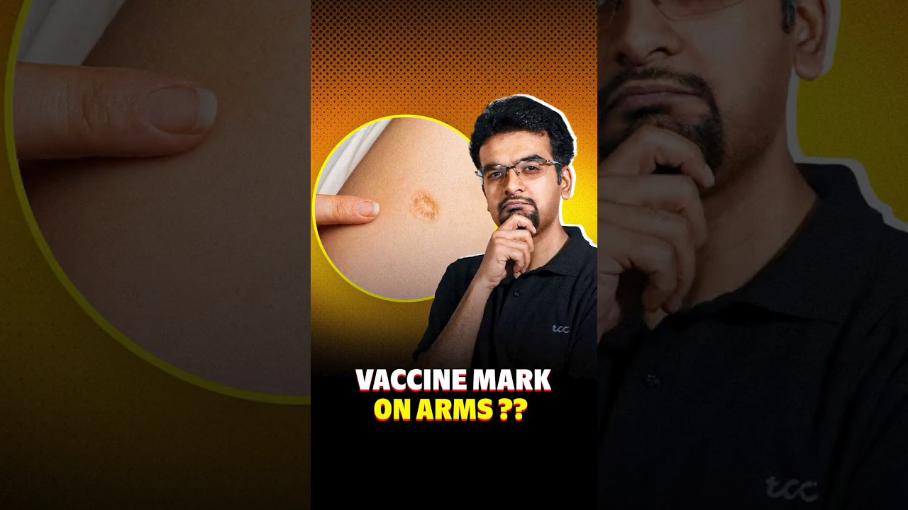 Why our parents have big vaccine marks?