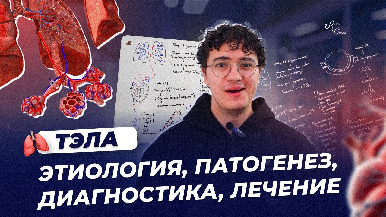 ТЭЛА  Этиология, патогенез, диагностика, лечение
