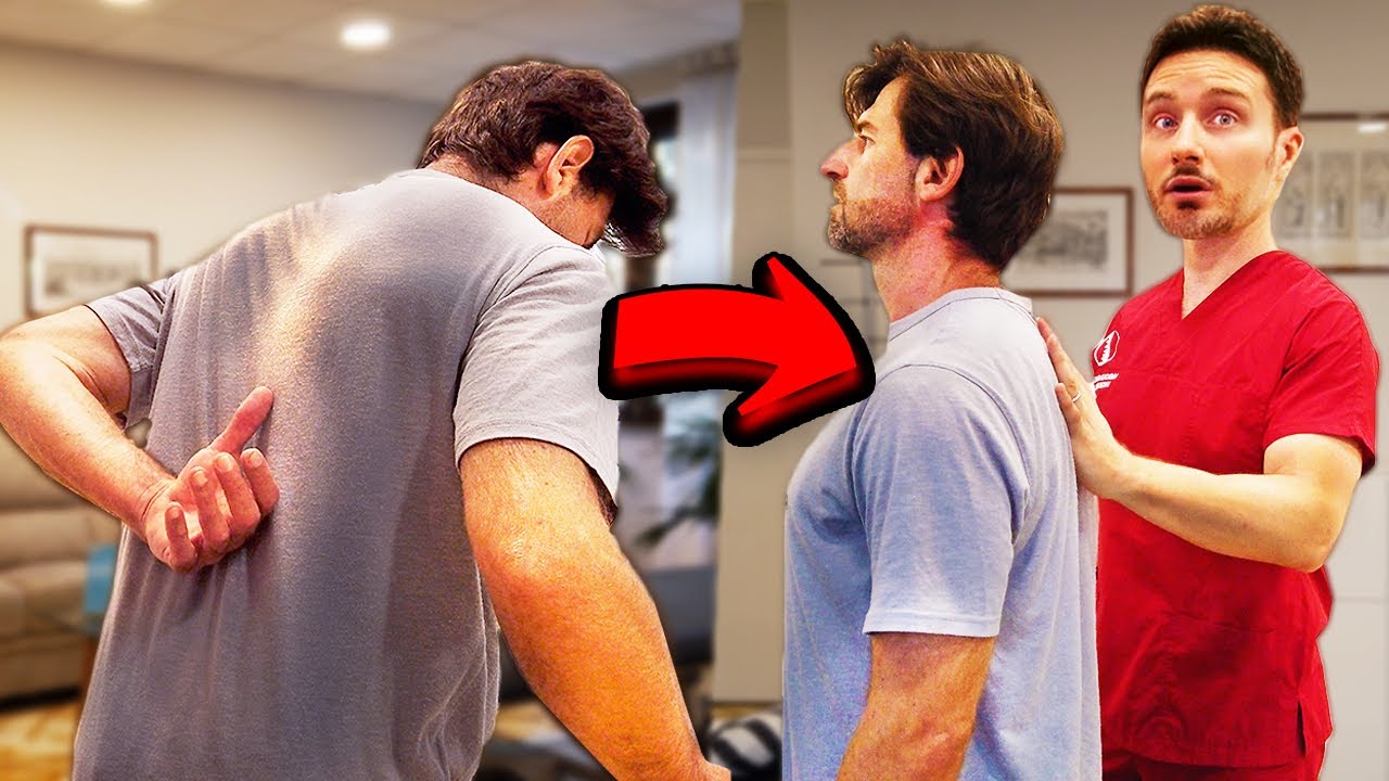 Severe Hyperkyphosis is FIXED with Chiropractic Cracking!