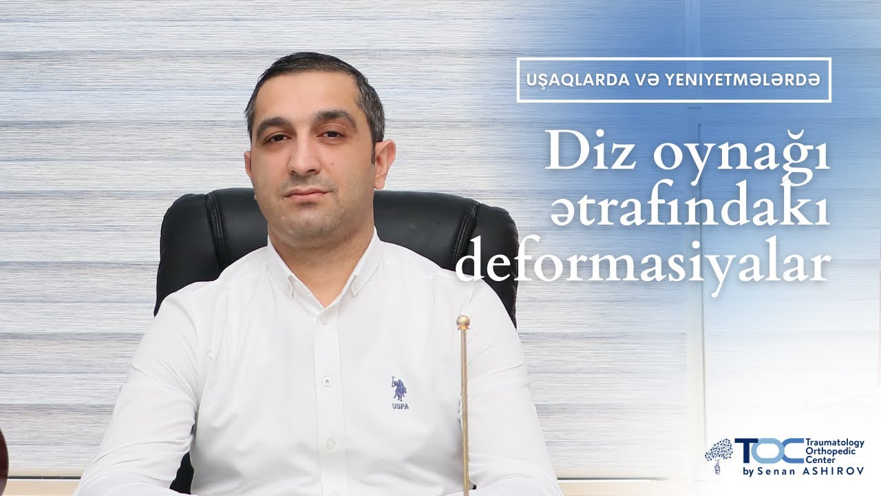 Diz oynağı ətrafındakı deformasiyalar