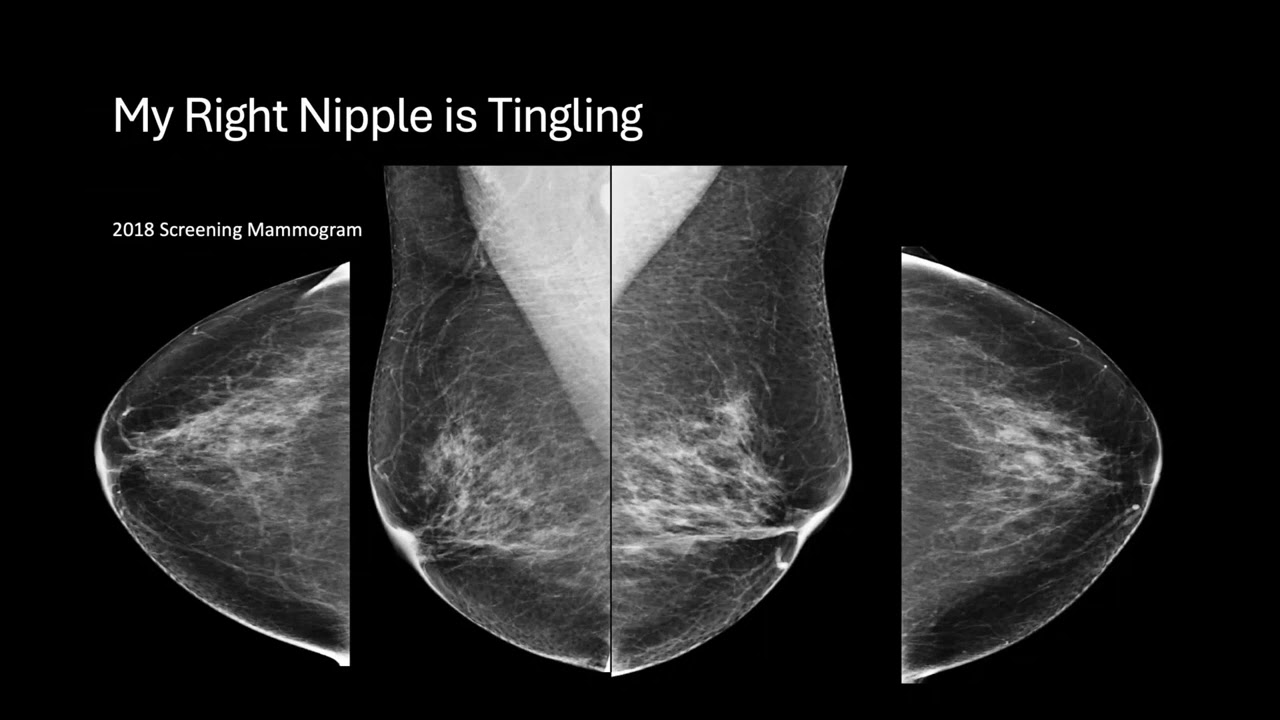 Interesting and Unusual Breast Imaging Cases - Sample
