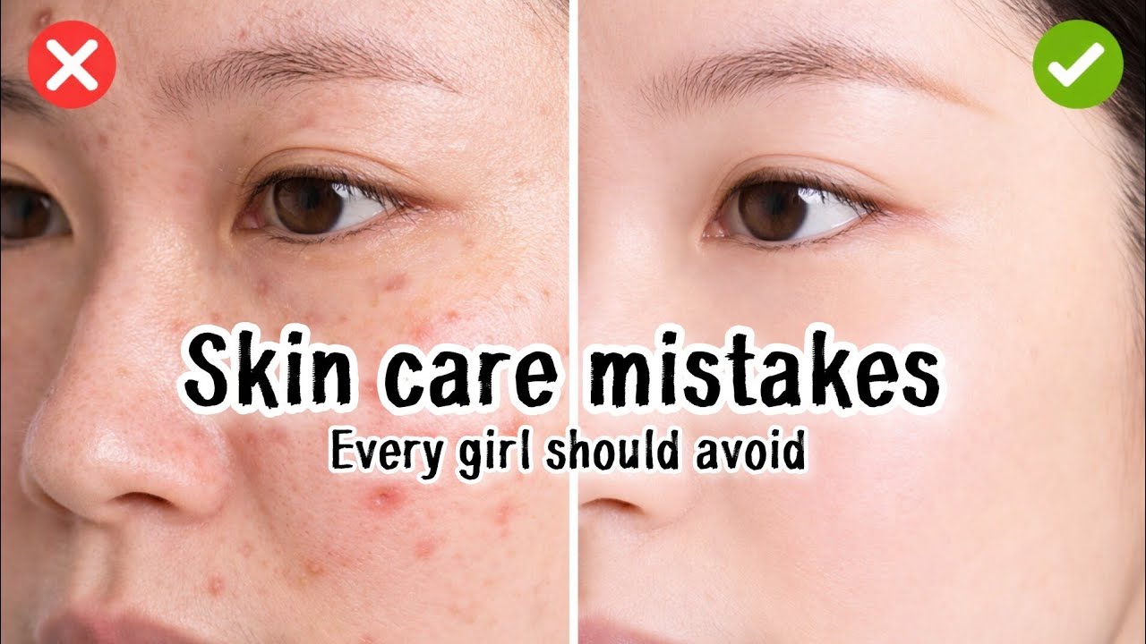 5 Skincare Mistakes Every Teen Girl Should Avoid 🚫✨