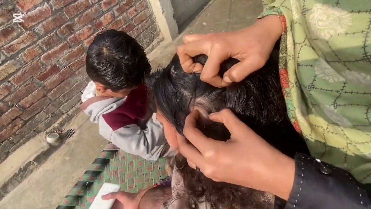 | @LaibaButt-b8t |#nitspicking #licepicking #lots of nits #pleasesubscribe #like #share #realsound |
