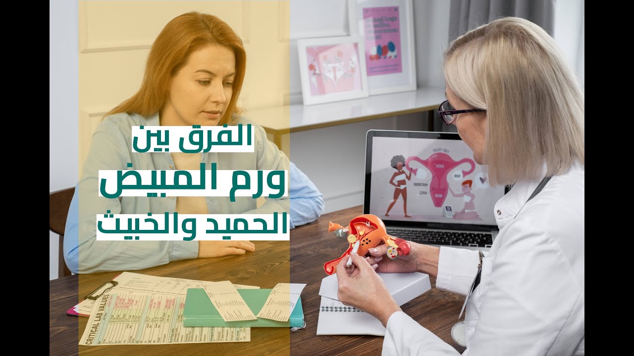 ما هو الفرق بين ورم المبيض الحميد والخبيث