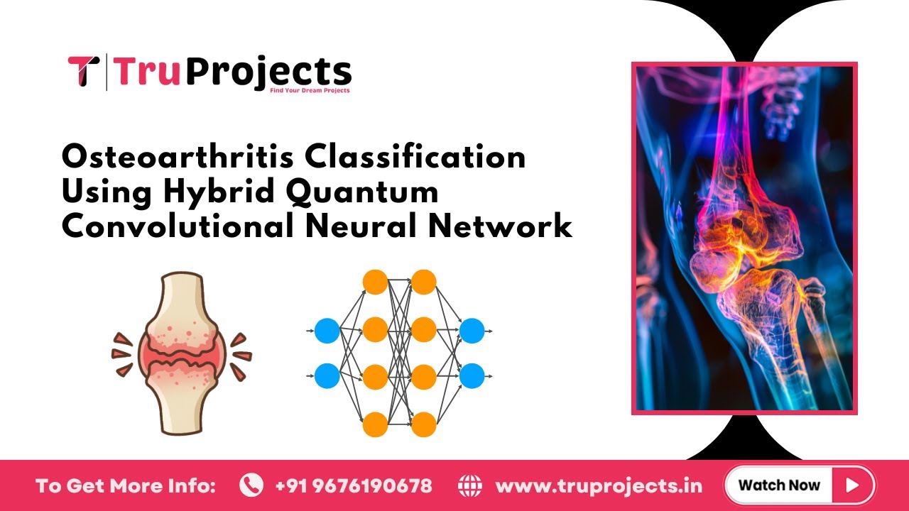 Osteoarthritis Classification Using Hybrid Quantum Convolutional Neural Network