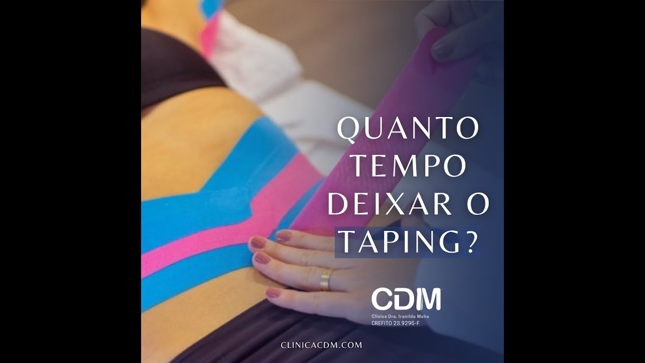 Quanto tempo permanecer com o taping no pós-operatório de uma cirurgia plástica?