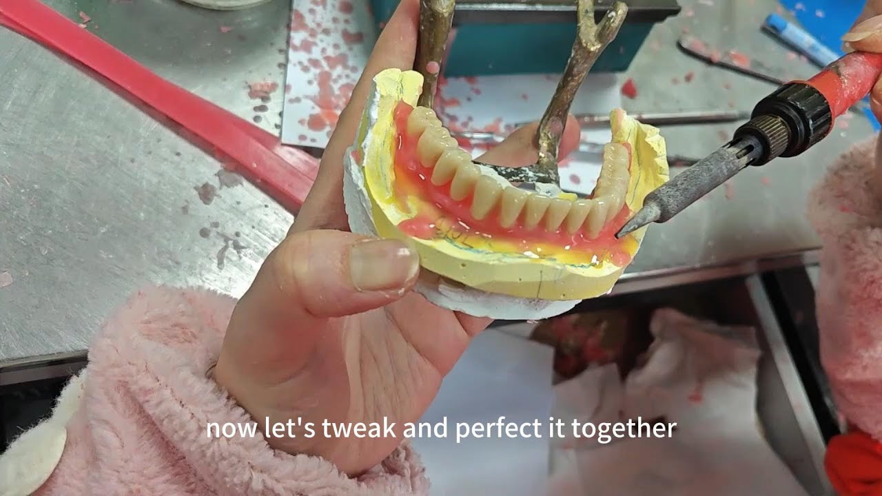 Complete Acrylic Denture#waxbae #denture