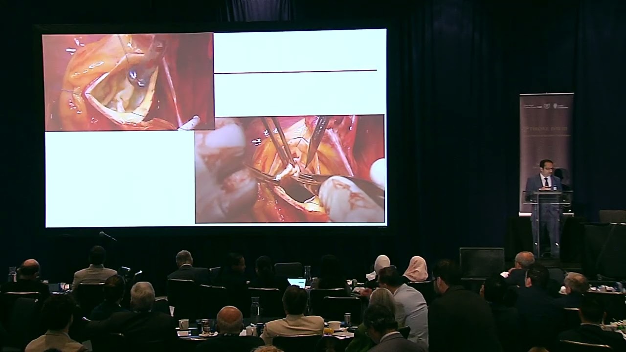 Asymmetric BAV repair - Munir Boodhwani
