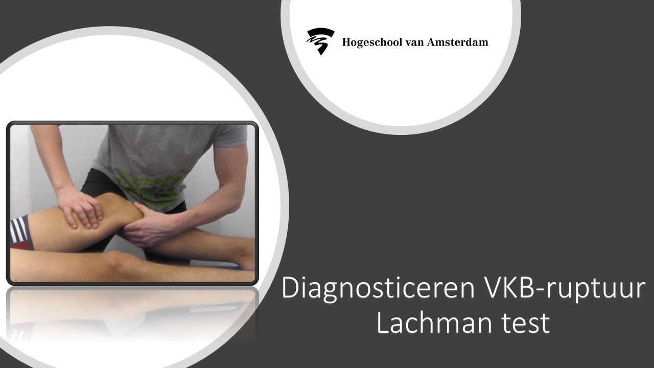 Lachman test diagnosticeren VKB-ruptuur
