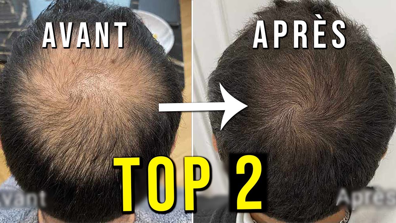 TOP 2 : Meilleur Shampoing Anti-Chute Cheveux (Mixte) | 2022 | Comparatif