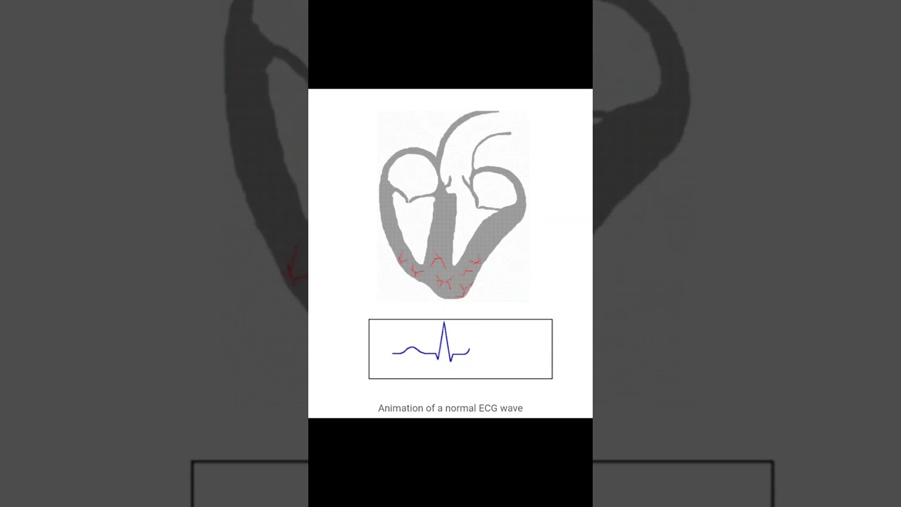 "A Normal ECG Wave🫀" 