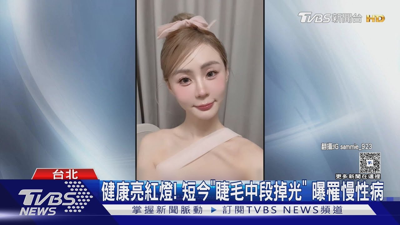 健康亮紅燈! 短今「睫毛中段掉光」 曝罹慢性病｜TVBS新聞 @TVBSNEWS01