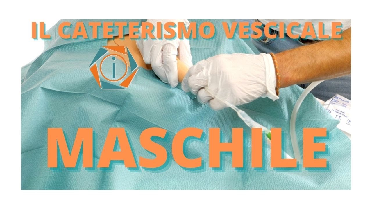 IL CATETERISMO VESCICALE MASCHILE | LA PROCEDURA | INFERMIERI online