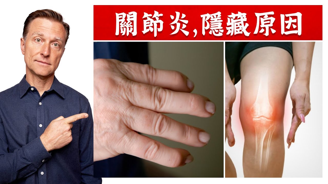 關節炎,隱藏原因和修復,柏格醫生 Dr Berg