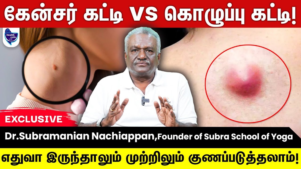 கேன்சர் கட்டி Vs கொழுப்பு கட்டி எப்படி வித்தியாசம் கண்டுபிடிக்கலாம் !! | Cancer