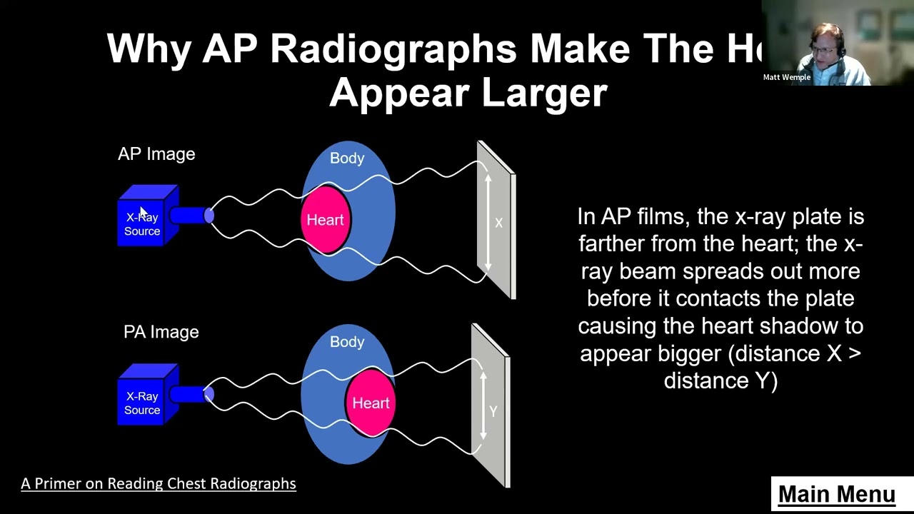 Reading XRays