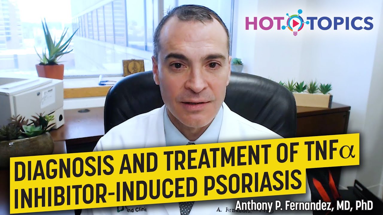 Diagnosis and Treatment of TNF Inhibitor-Induced Psoriasis