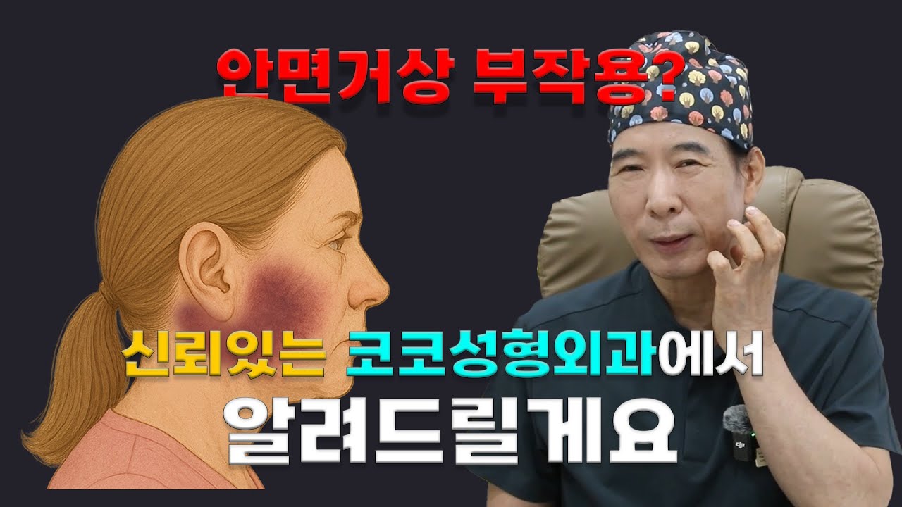 [코코성형외과]  안면거상의 부작용? 파헤쳐 봅시다! -1편