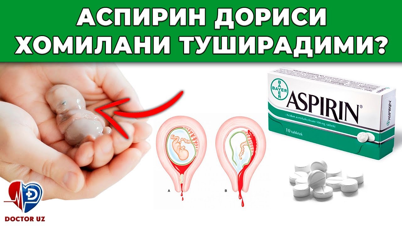 ДИҚҚАТ! АСПИРИН ДОРИСИ ХОМИЛАНИ ТУШИРАДИМИ😱😱