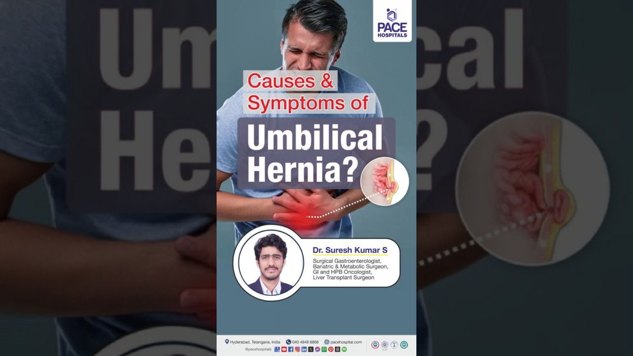 What are the Causes & Symptoms of Umbilical Hernia? | Causes and Signs of an Umbilical Hernia