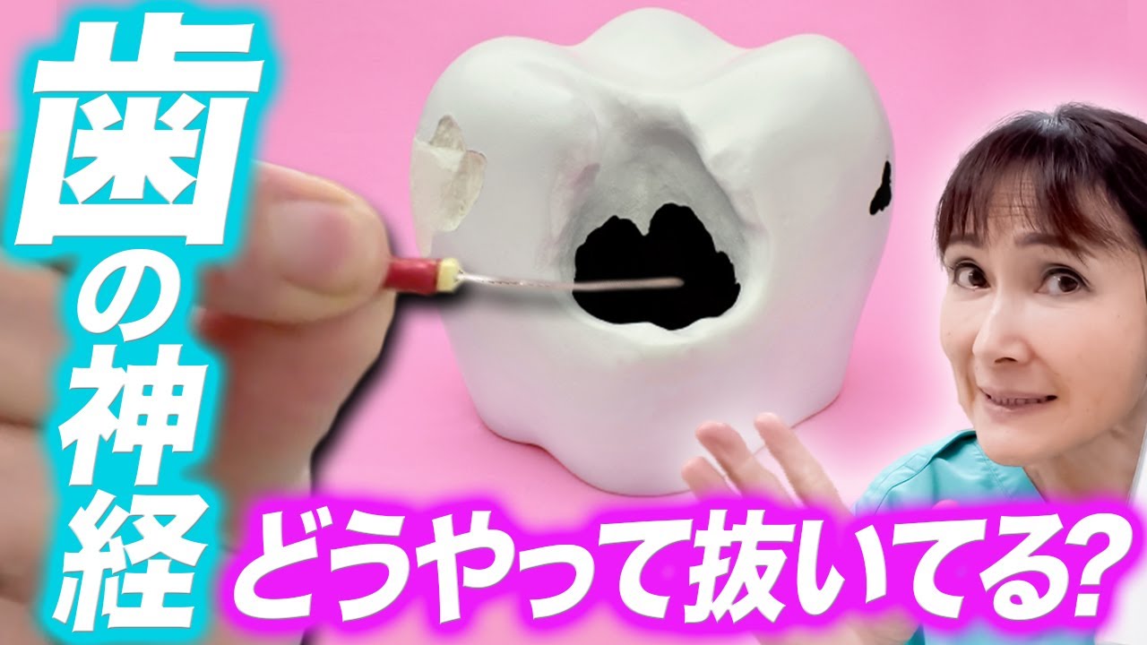 【根管治療 神経 痛い】歯の神経を抜く治療、なぜ痛い？何をしている？