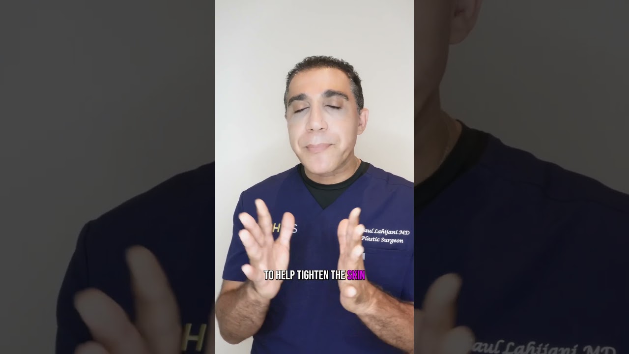 Loose Skin After Liposuction? Watch the full video on on Instagram! #liposuction #plasticsurgery