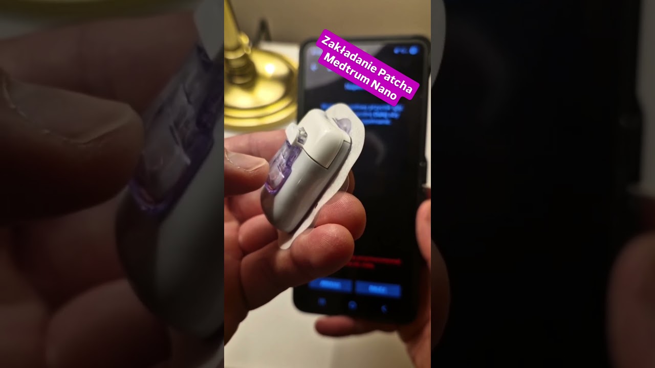 Tak wygląda zakładanie nowego patcha w pompie Medtrum Nano. #medtrum #androidaps