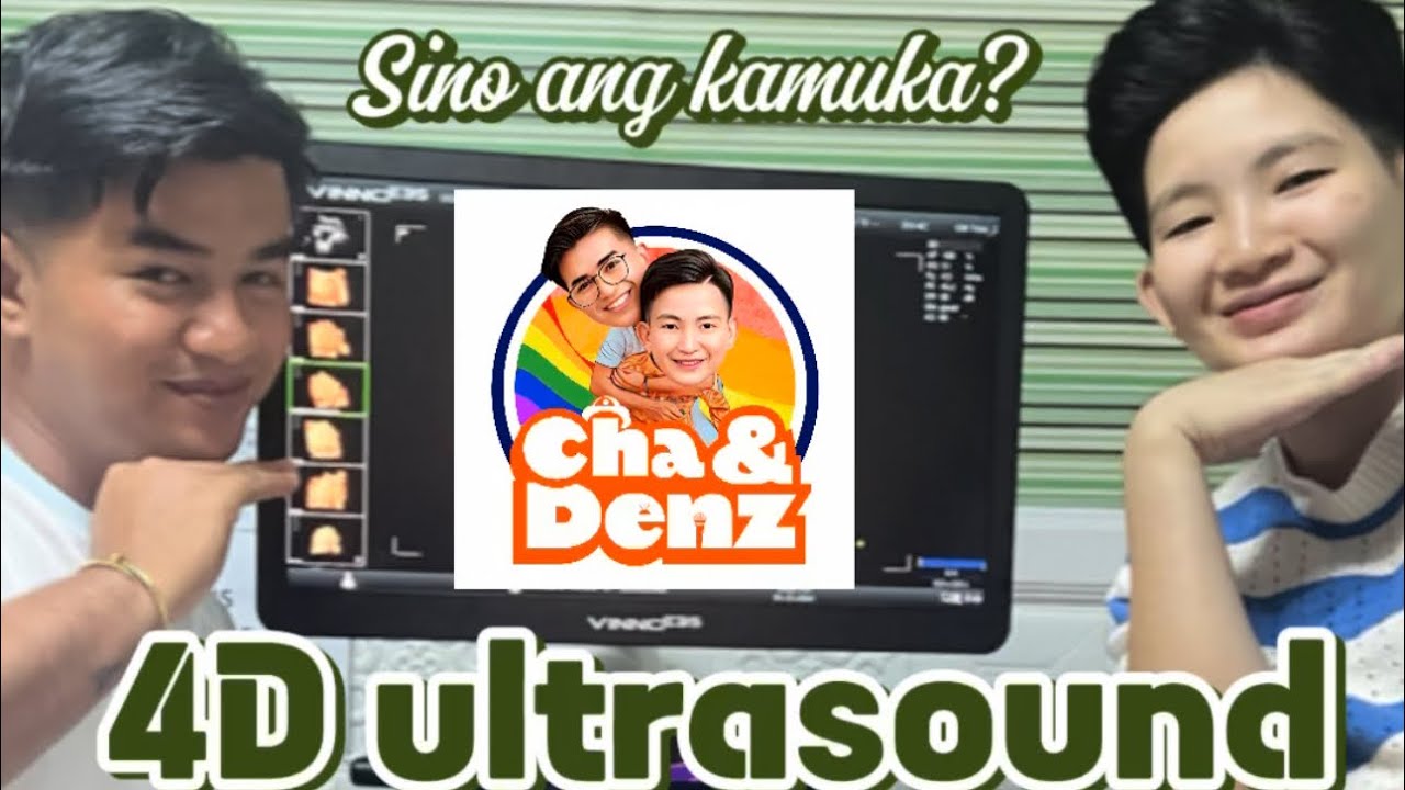4d ultrasound |Sino ang kamuka?| #chaanddenz 🌈 #gayandlesbiancouple🏳️‍🌈