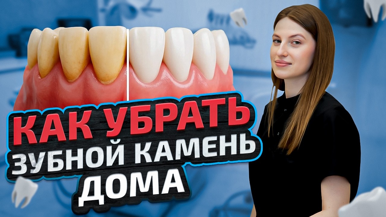 Как убрать зубной камень самостоятельно? Только правда о домашних методах